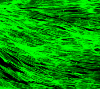 Contracted TM cells