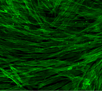 Normal TM cells